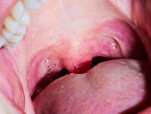 Fotoschule-Koeln | Fotokurse in Köln |